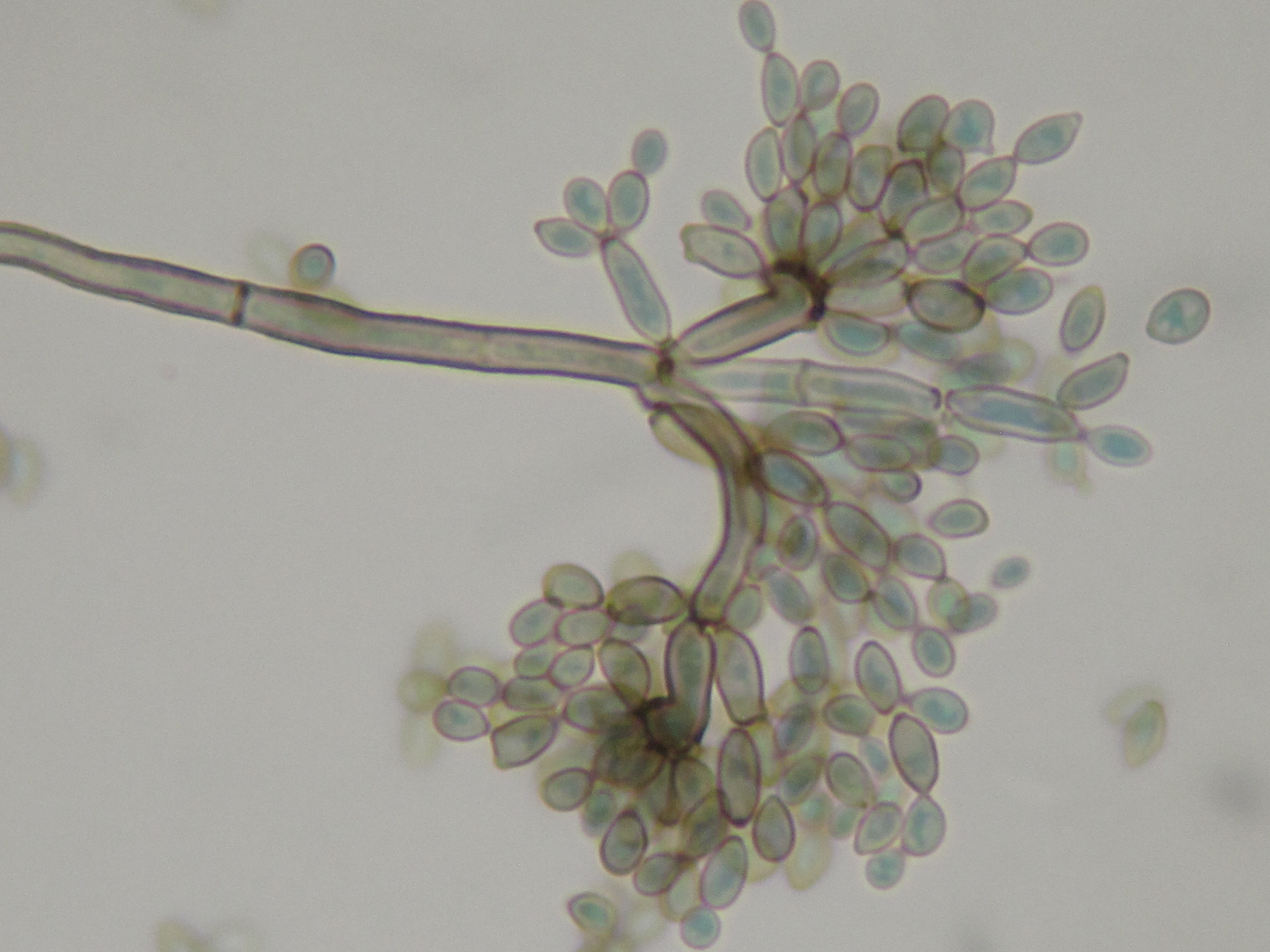 Мицелий грибов представлен одноклеточными. Гриб Cladosporium herbarum. Cladosporium resinae. Плесень Cladosporium. Cladosporium werneckii морфология.